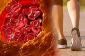 sessiz-katilin-ilk-belirtisi-yururken-ortaya-cikiyor!-tedavi-edilmezse-felc-ve-kalp-krizi-riski-yuksek