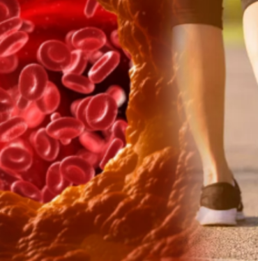 sessiz-katilin-ilk-belirtisi-yururken-ortaya-cikiyor!-tedavi-edilmezse-felc-ve-kalp-krizi-riski-yuksek