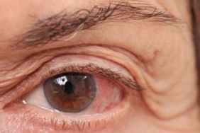 kalici-gorme-kaybinin-en-onemli-3.-nedeni!