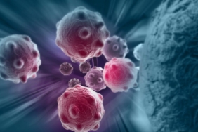 bilim-insanlari-kisiye-ozel-kanser-tedavisi-uzerine-calisiyor