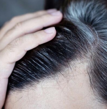 beyaz-saclardan-kurtulmanin-dogal-yolu!-cope-attiginiz-her-gun-icin-pisman-olacaksiniz