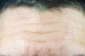 bu-goruntunun-altinda-korkunc-bir-gercek-var!-sizde-de-varsa-doktora-kosun