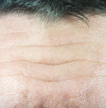 bu-goruntunun-altinda-korkunc-bir-gercek-var!-sizde-de-varsa-doktora-kosun