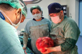 fazla-kilo-aldi-sandi-ama-gercekler-bambaska-cikti!-karnindan-cikanlar-gorenleri-hayrete-dusurdu