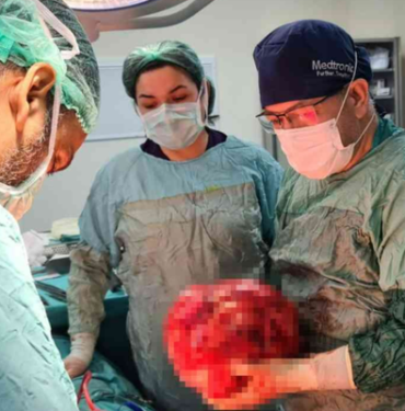 fazla-kilo-aldi-sandi-ama-gercekler-bambaska-cikti!-karnindan-cikanlar-gorenleri-hayrete-dusurdu