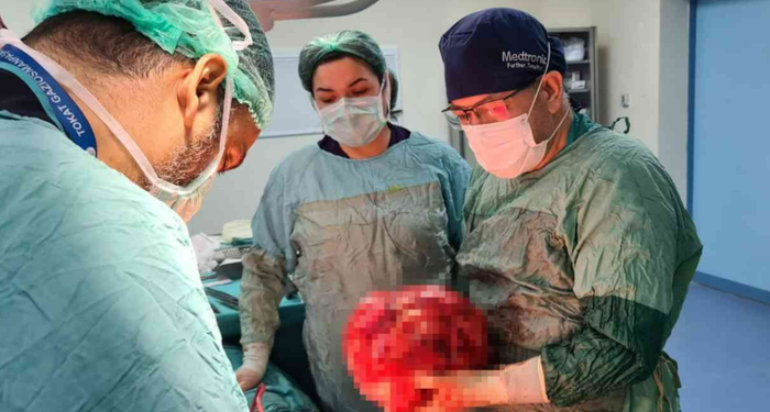 Fazla kilo aldı sandı ama gerçekler bambaşka çıktı! Karnından çıkanlar görenleri hayrete düşürdü