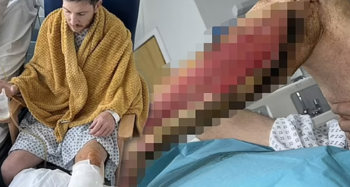 amator-futbolcu-neredeyse-bacagini-kaybediyordu!-kimse-bu-riskin-farkinda-degil