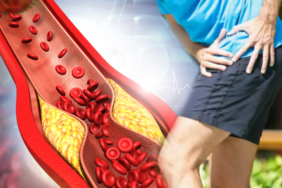 her-sey-bu-belirtiyle-basliyor:-gormezden-gelmeyin!-tehlikeli-hastaligi-erken-teshis-edin