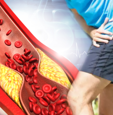 her-sey-bu-belirtiyle-basliyor:-gormezden-gelmeyin!-tehlikeli-hastaligi-erken-teshis-edin