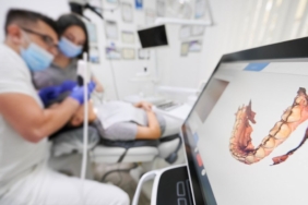 dis-hekimliginde-3d-tarayici-ile-olcu-alma-derdi-geride-kaldi!