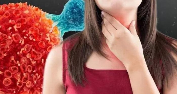 Yemek borusu kanserinin ilk belirtisidir! ‘Gecikmeden doktorunuza görünün’