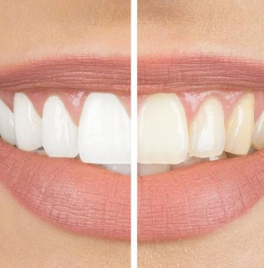 dis-sagligi-aksatmaya-gelmez!-sagliginizi-bastan-asagi-etkiliyor