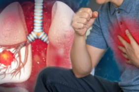 hemen-kirip-atin:-akciger-kanserinin-yuzde-90-sebebi!-oyle-zararlari-var-ki…