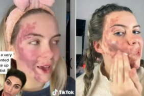tiktok’ta-hastaligini-paylasti!-dermatolog-tarafindan-sahtekarlikla-suclandi