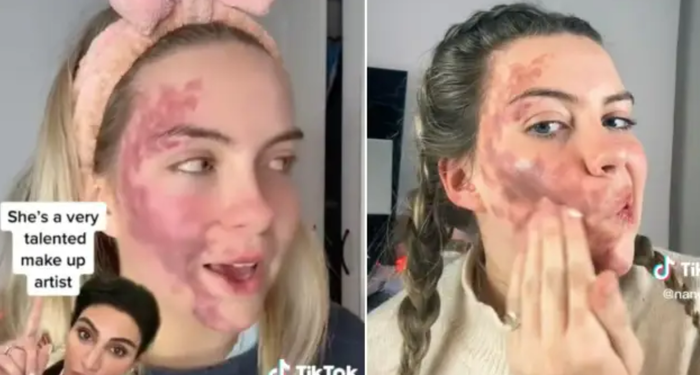 TikTok’ta hastalığını paylaştı! Dermatolog tarafından sahtekarlıkla suçlandı