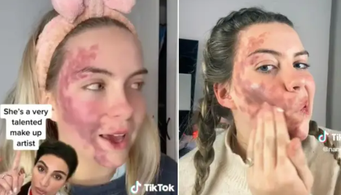 tiktok’ta-hastaligini-paylasti!-dermatolog-tarafindan-sahtekarlikla-suclandi