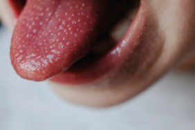 olumcul-strep-a-salgini-artarken-her-ebeveynin-bilmesi-gereken-belirtiler!-erken-onlem-alin