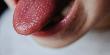 olumcul-strep-a-salgini-artarken-her-ebeveynin-bilmesi-gereken-belirtiler!-erken-onlem-alin