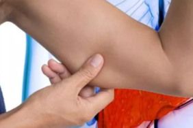 dikkat!-belirti-vermeden-sinsice-ilerleyerek-karacigeri-mahvediyor…-hastalarin-neredeyse-yarisi-ayni-belirtiyi-yasiyor