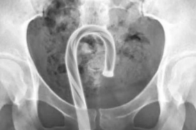 tehlikeli-trend-giderek-yayiliyor!-masturbasyon-hakkinda-uyari-verildi
