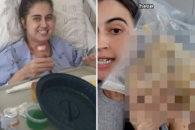 nakilden-sonra-eski-kalbini-plastik-bir-posette-tutuyor!-kalbini-saklama-nedeni…