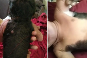 hindistan’da-dunyaya-gelen-bebek-doktorlari-hayrete-dusurdu!-vucudunun-yarisi-killa-kapli