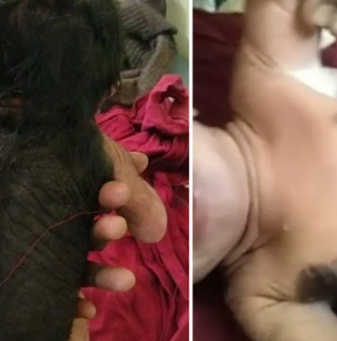 hindistan’da-dunyaya-gelen-bebek-doktorlari-hayrete-dusurdu!-vucudunun-yarisi-killa-kapli