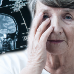 her-sey-onceden-hissediliyormus!-alzheimer’in-en-erken-belirtilerine-dikkat
