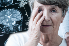 her-sey-onceden-hissediliyormus!-alzheimer’in-en-erken-belirtilerine-dikkat