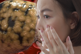 cildinizde-ortaya-cikan-degisimlere-dikkat!-tehlikeli-hastaligin-buyuk-uyaricisi