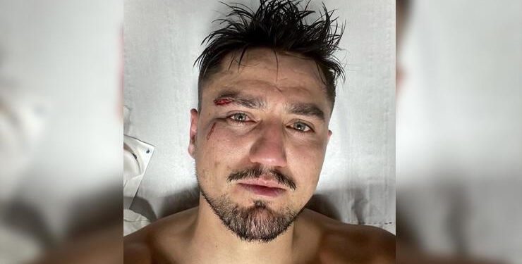Cengiz Ünder ölümden döndü! Şok görüntü