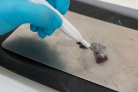 tumor-koklayan-bicak,-rahim-kanserini-saniyeler-icinde-tespit-edebilir