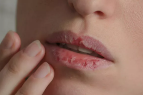 onemsiz-goruluyor-ama-ciddi-hastaliklari-habercisi-olabilir!-agiz-kurulugu-onceden-uyari-veriyor