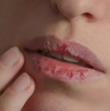 onemsiz-goruluyor-ama-ciddi-hastaliklari-habercisi-olabilir!-agiz-kurulugu-onceden-uyari-veriyor