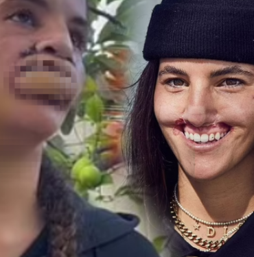 pitbull-saldirisi-nedeniyle-gulusunu-kaybetti!-dehset-anlarini-teker-teker-anlatti