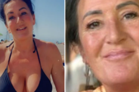 sadece-goguslerini-buyutmek-istemisti…-turkiye’de-oldugu-ameliyat-nedeniyle-gogsu-patladi