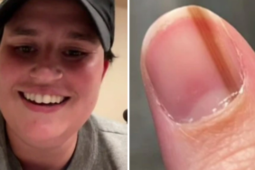 tirnak-cizgisinin-havali-oldugunu-dusundu!-gercekleri-ogrenince-hayatinin-sokunu-yasadi:-olumcul-hastaligin-belirtisi