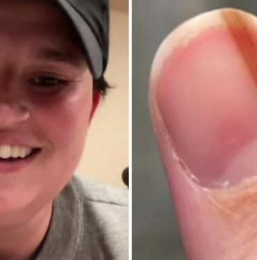 tirnak-cizgisinin-havali-oldugunu-dusundu!-gercekleri-ogrenince-hayatinin-sokunu-yasadi:-olumcul-hastaligin-belirtisi