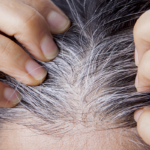 beyaz-saclardan-dogal-bir-sekilde-tamamen-kurtulacaksiniz!-hazineyi-yillarca-cope-atmisiz