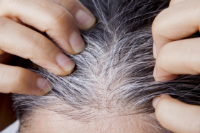 beyaz-saclardan-dogal-bir-sekilde-tamamen-kurtulacaksiniz!-hazineyi-yillarca-cope-atmisiz