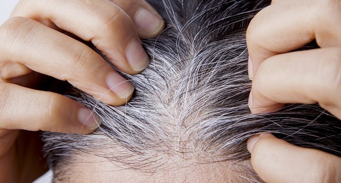 beyaz-saclardan-dogal-bir-sekilde-tamamen-kurtulacaksiniz!-hazineyi-yillarca-cope-atmisiz