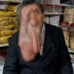 hastaligi-nedeniyle-yuzu-zamanla-erimeye-basladi!-“ozgurce-hareket-edemiyorum”