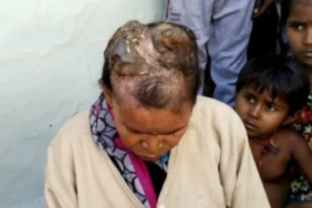 kimse-inanmamisti!-kafasinda-boynuzlar-cikan-kadinin-cektigi-acinin-tarifi-yok