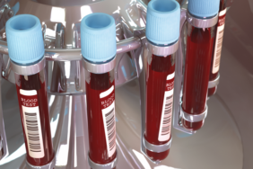 bu-kan-grubuna-sahipseniz-en-zeki-sizsiniz!-kan-grubunuza-gore-kisilik-ozellikleriniz