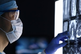 20’li-yaslarda-basliyor!-her-2-dakikada-bir-can-aliyor…-dikkat:-turkiye’de-3.-sirada