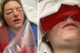 sadece-kurabiye-yapmak-istemisti!-bir-anda-yuzunde-patladi…-neredeyse-kor-kaliyordu!