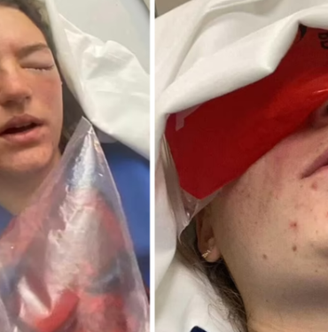 sadece-kurabiye-yapmak-istemisti!-bir-anda-yuzunde-patladi…-neredeyse-kor-kaliyordu!