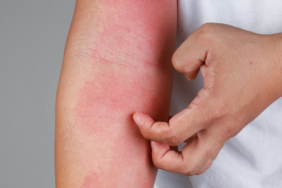 dikkat!-turkiye’de-sayi-giderek-artiyor…-belirti-gostermeden-hizlica-bulasiyor!