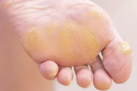 ayak-nasirinin-kokunu-kurutuyor!-her-evde-bulunuyor