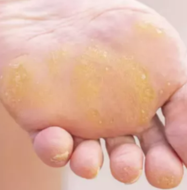 ayak-nasirinin-kokunu-kurutuyor!-her-evde-bulunuyor